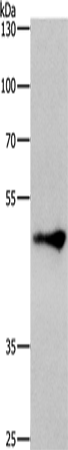 Anti-ZIC 3 Rabbit Polyclonal Antibody