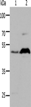 Anti-HTR1A Rabbit Polyclonal Antibody