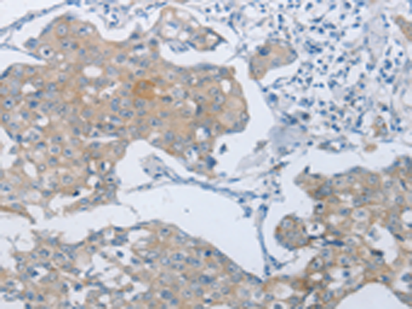 Anti-PGP9 Rabbit Polyclonal Antibody