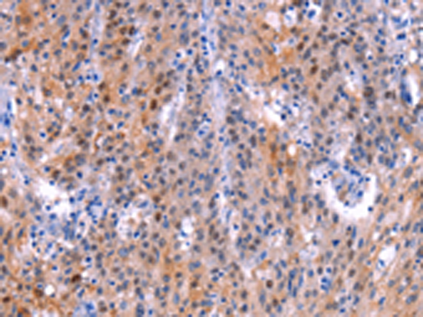 Anti-ADM2 Rabbit Polyclonal Antibody