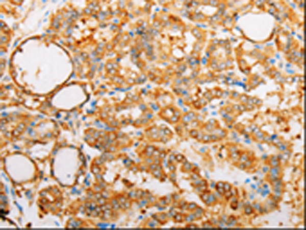 Anti-ARF1 Rabbit Polyclonal Antibody