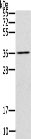 Anti-UBXN2A Rabbit Polyclonal Antibody