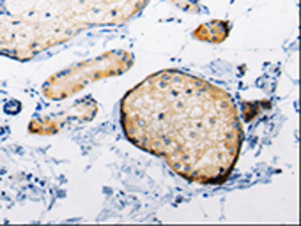 Anti-Rab6A Rabbit Polyclonal Antibody