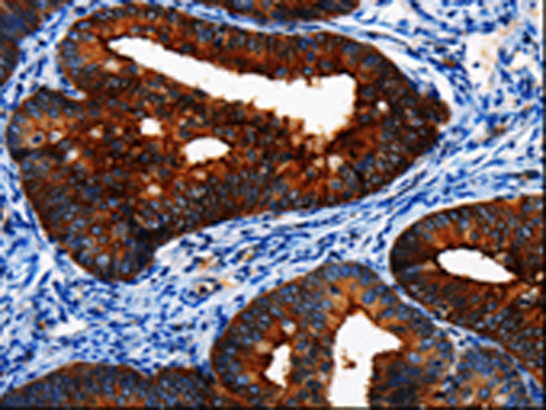 Anti-BIRC6 Rabbit Polyclonal Antibody