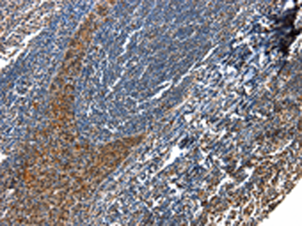 Anti-Aquaporin 2 Rabbit Polyclonal Antibody