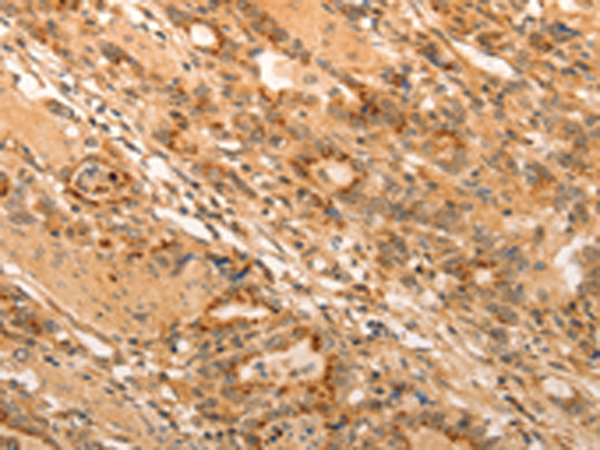 Anti-ADRA1B Rabbit Polyclonal Antibody