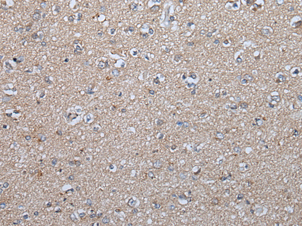 Anti-FGF5 Rabbit Polyclonal Antibody