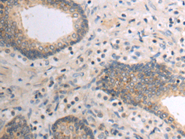 Anti-CCL17 Rabbit Polyclonal Antibody