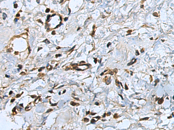 Anti-CEBPD Rabbit Polyclonal Antibody