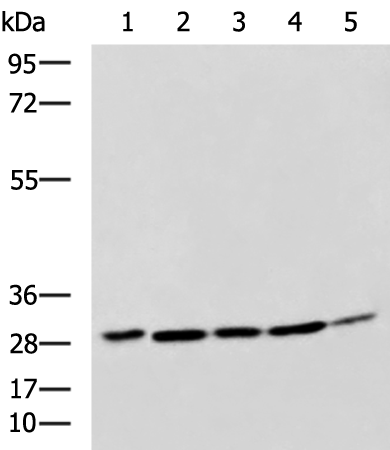 Anti-CEBPD Rabbit Polyclonal Antibody