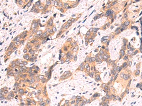 Anti-CFTR Rabbit Polyclonal Antibody