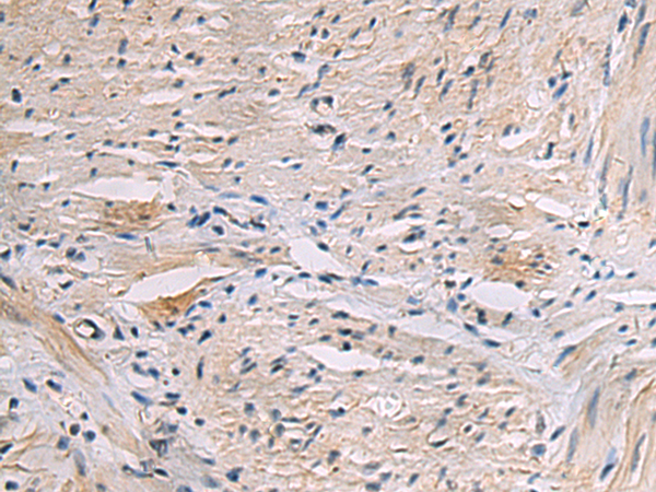 Anti-CRMP5 Rabbit Polyclonal Antibody
