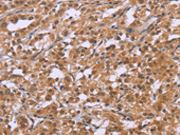 Anti-CRH Rabbit Polyclonal Antibody