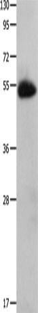 Anti-CX3CR1 Rabbit Polyclonal Antibody