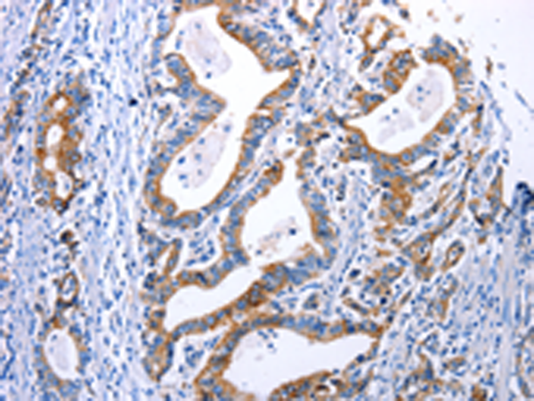 Anti-Dopamine Receptor D4 Rabbit Polyclonal Antibody