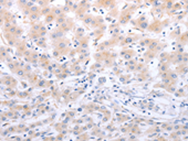 Anti-DAP3 Rabbit Polyclonal Antibody