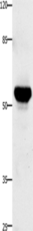 Anti-TNFRSF21 Rabbit Polyclonal Antibody