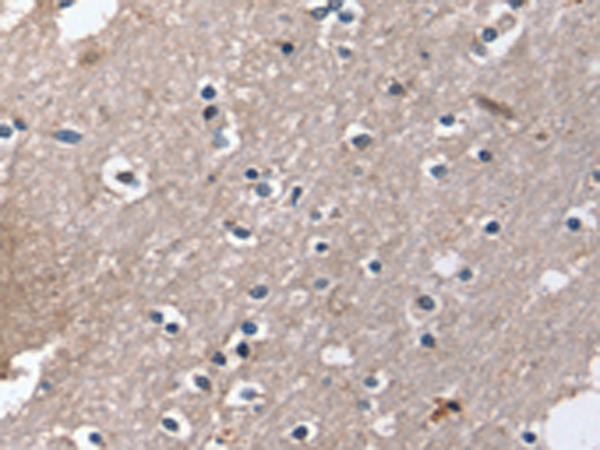 Anti-DUT Rabbit Polyclonal Antibody