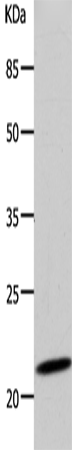 Anti-DUT Rabbit Polyclonal Antibody