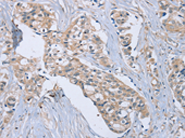 Anti-EDA Rabbit Polyclonal Antibody