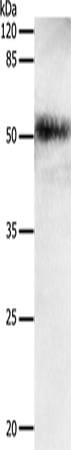 Anti-EDA Rabbit Polyclonal Antibody
