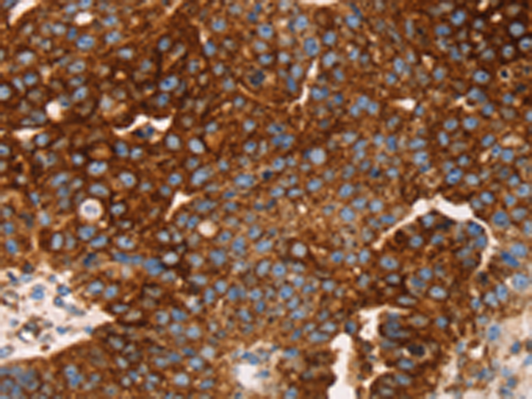 Anti-EDAR Rabbit Polyclonal Antibody