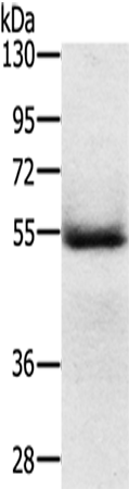 Anti-EDAR Rabbit Polyclonal Antibody