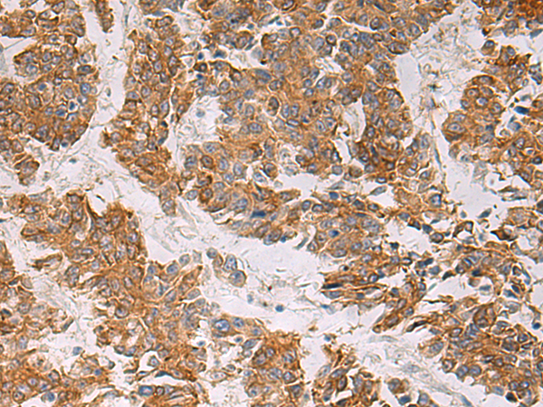 Anti-Endothelin Receptor B Rabbit Polyclonal Antibody