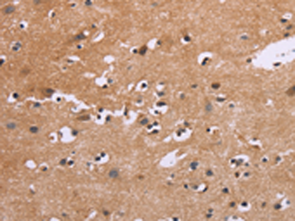 Anti-EGR4 Rabbit Polyclonal Antibody