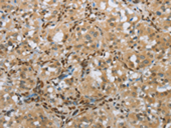 Anti-FOXE1 Rabbit Polyclonal Antibody