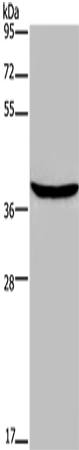 Anti-FOXE1 Rabbit Polyclonal Antibody
