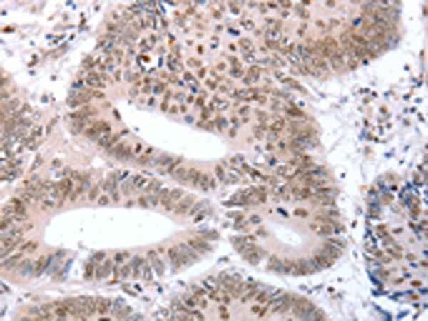Anti-T Box Protein 2 Rabbit Polyclonal Antibody