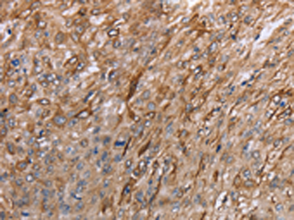 Anti-GRPR Rabbit Polyclonal Antibody