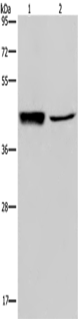 Anti-GRPR Rabbit Polyclonal Antibody