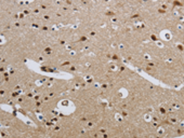Anti-CMTM8 Rabbit Polyclonal Antibody