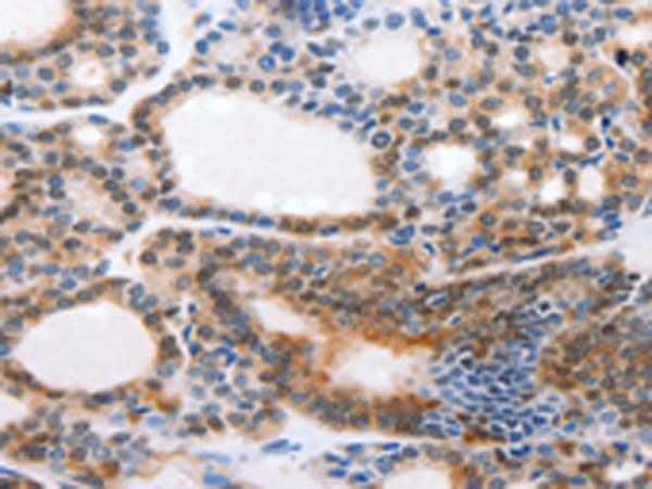 Anti-CMTM3 Rabbit Polyclonal Antibody