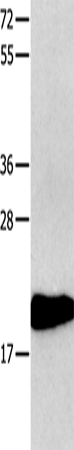 Anti-CMTM3 Rabbit Polyclonal Antibody