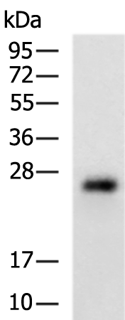 Anti-CMTM2 Rabbit Polyclonal Antibody