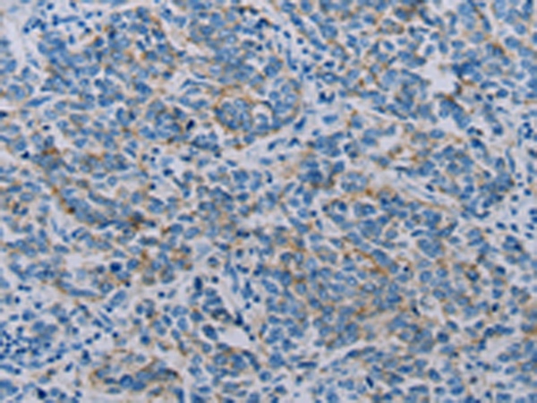 Anti-Claudin 4 Rabbit Polyclonal Antibody