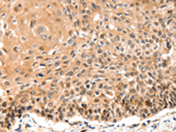 Anti-GAS6 Rabbit Polyclonal Antibody