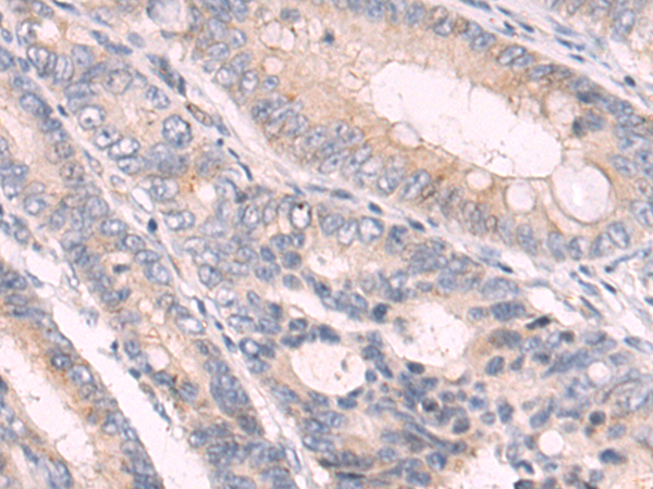 Anti-GFRA3 Rabbit Polyclonal Antibody