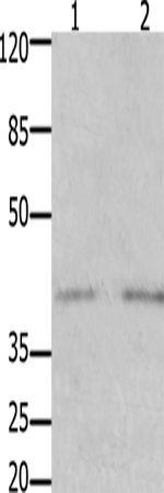 Anti-GFRA3 Rabbit Polyclonal Antibody