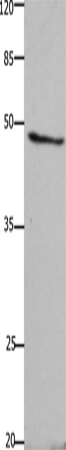 Anti-GHSR Rabbit Polyclonal Antibody