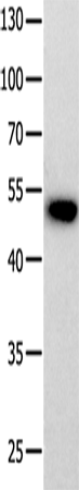 Anti-PROKR2 Rabbit Polyclonal Antibody