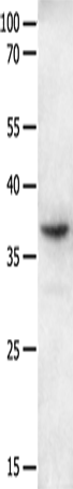 Anti-GPR6 Rabbit Polyclonal Antibody