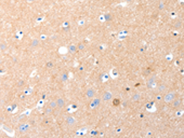 Anti-mGluR1 Rabbit Polyclonal Antibody