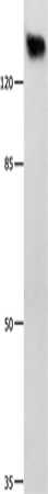Anti-mGluR1 Rabbit Polyclonal Antibody