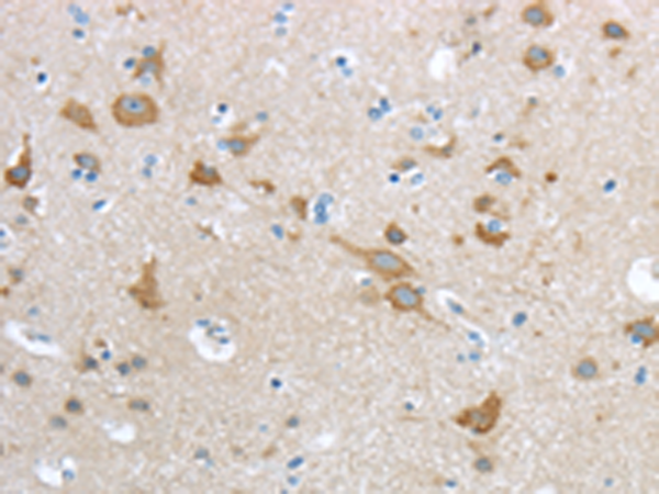 Anti-HCN4 Rabbit Polyclonal Antibody