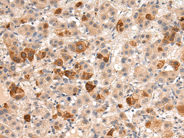 Anti-HINT3 Rabbit Polyclonal Antibody