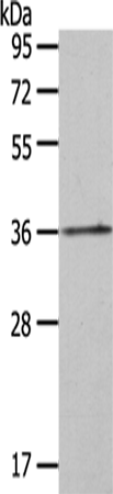 Anti-HOXA11 Rabbit Polyclonal Antibody